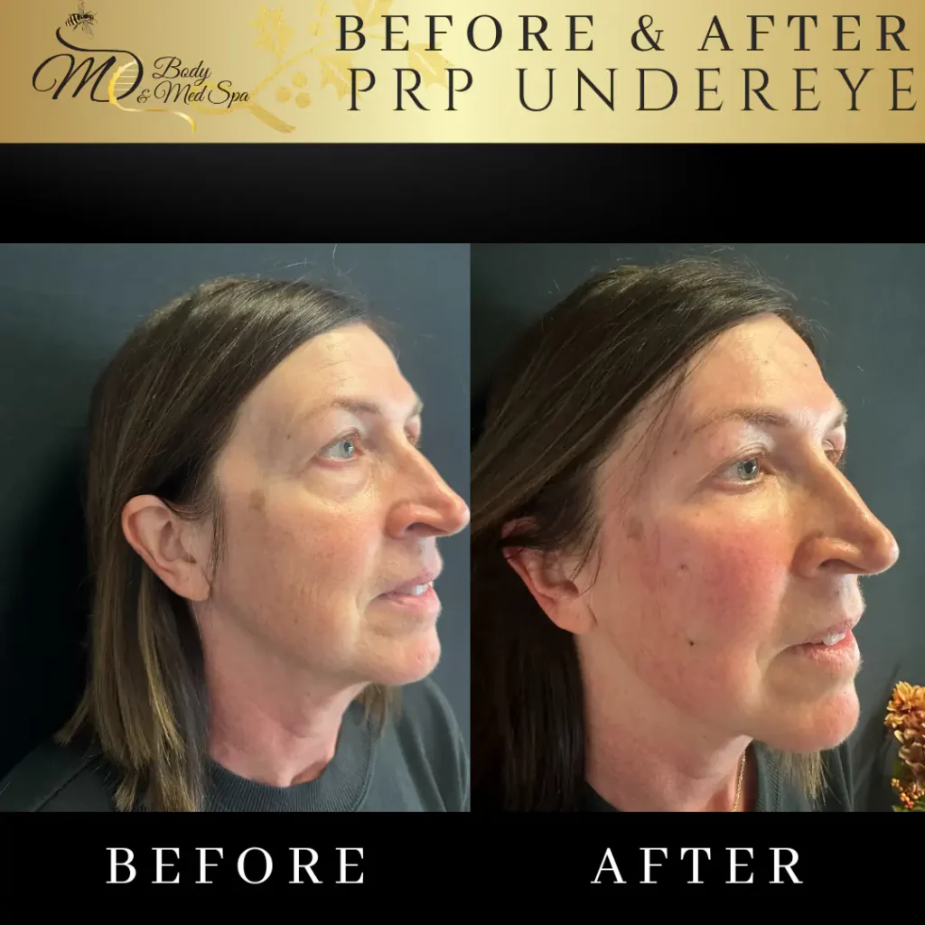 Best Under Eye Patches for Puffiness: A Buyer's Guide